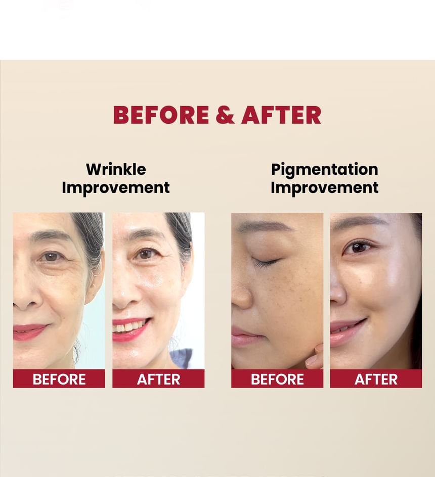 KSECRET - SEOUL 1988 Serum : Retinal Liposome 2% + Black Ginseng - 30m