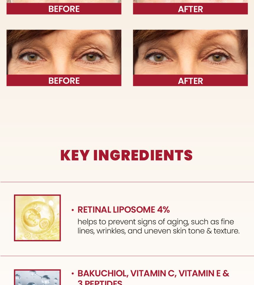 KSECRET - SEOUL 1988 Eye Cream : Retinal Liposome 4% + Fermented Bean - 30ml